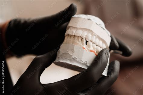 Foto De Plaster Cast Of Jaws Dentist In Black Gloves Holding Dental