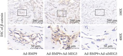 Effects Of Meg3 On Gsk 3ββ Catenin Axis In Mefs A Download Scientific Diagram