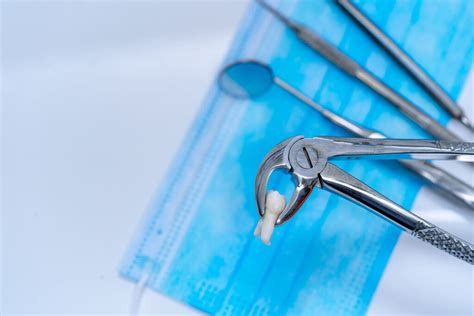 Estrazione Denti E Piccola Chirurgia Dentista A Domicilio