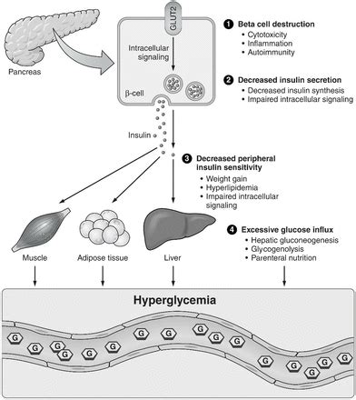 Medication Induced Hyperglycemia Pediatric Perspective Bmj Open