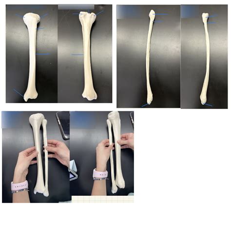 Human Tibia and Fibula Diagram | Quizlet