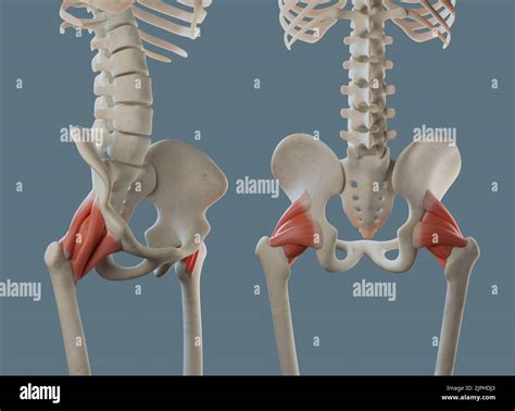 Hip joint anatomy, including ligaments and muscle attachments. Multiple ...