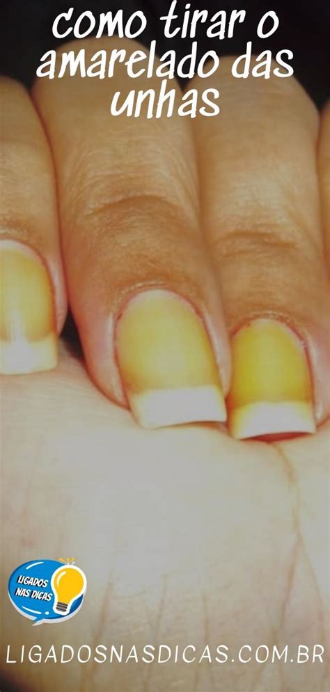 Tirar Amarelo Das Unhas - Como Tirar O Amarelado Das Unhas | Ligados Nas Dicas | Nails at home ...