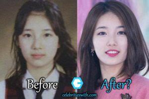 Bae Suzy Plastic Surgery: Eyelid-Nose Surgery Rumors, Before After Pics ...