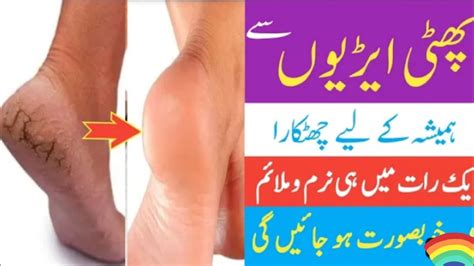 Crack Heels Home Remedy Phati Ariyan Ka Ilaj Removed Cracket Heels