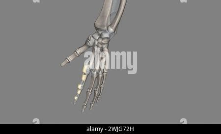 The annular ligament is a complex structure formed from the capsule ...