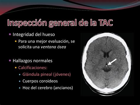 Interpretacion De Tac De CrÁneo Fase Simple