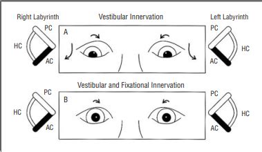 SUPERIOR OBLIQUE MUSCLE OVERACTION - Optography