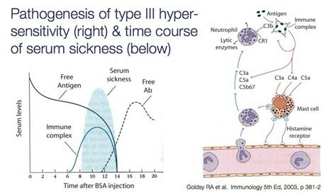 Serum Sickness Immunology Hypersensitivity Ace Inhibitors