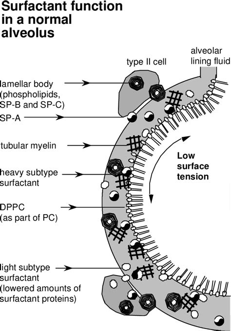 Figure 1 from Pulmonary surfactant and lung transplantation | Semantic ...