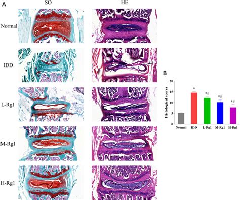 Effect Of Ginsenoside Rg On Pathology Of Nucleus Pulposus Tissues In