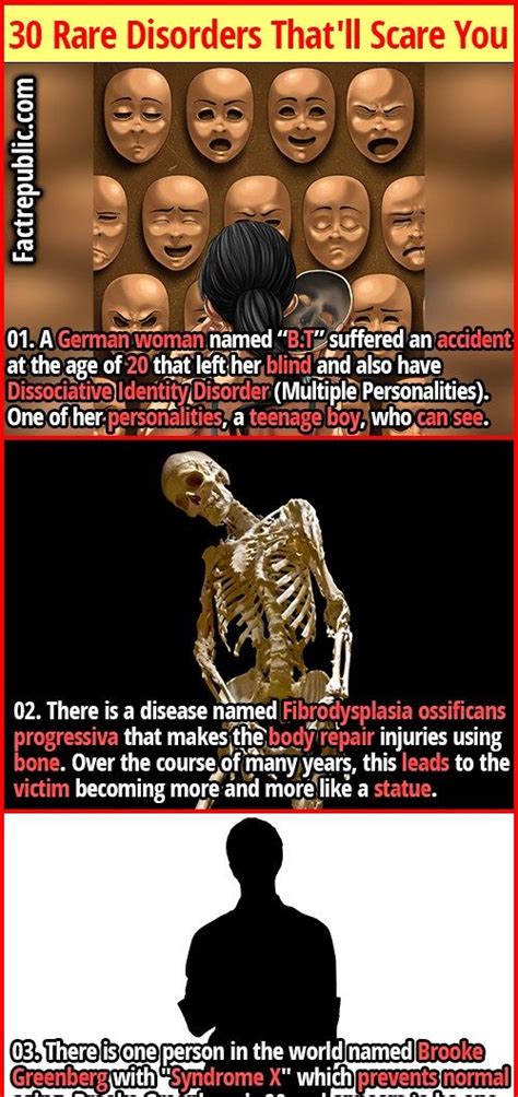 30 Frightening Facts About Rare Disorders That Ll Leave You Sleepless