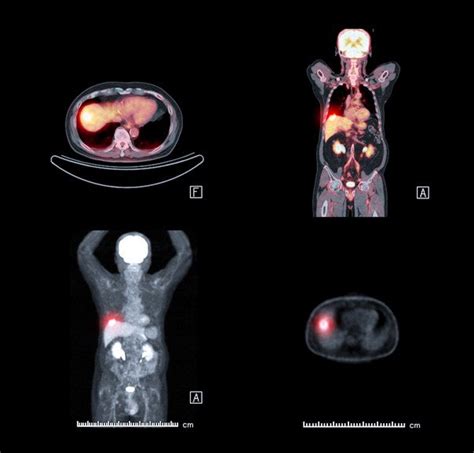 Radionuclide Scanning Guide