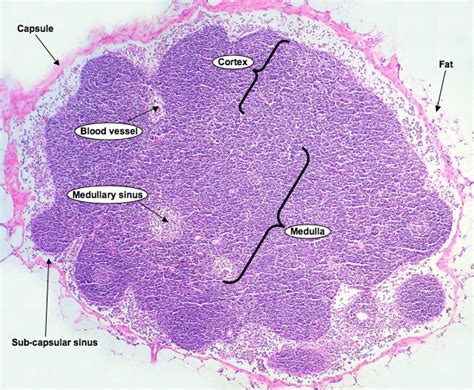 HistoQuarterly: LYMPH NODE | Histology Blog