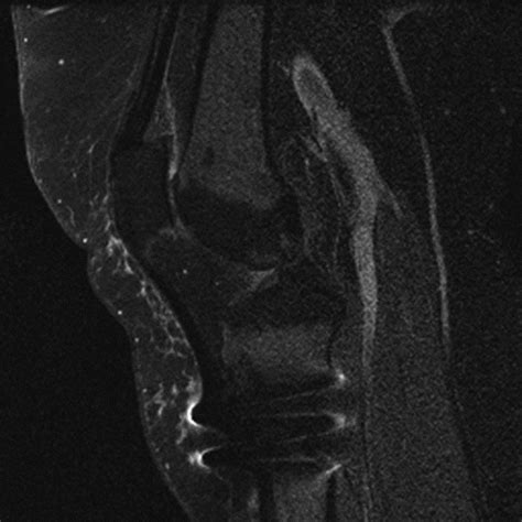 Medical Apparatus Imaging Protocols Mri