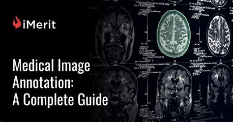 Medical Image Annotation A Complete Guide Imerit