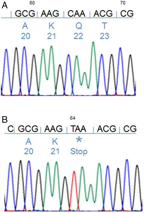 Partial Dna Sequence Chromatogram Of Dax1 Exon 1 Top Line Shows The Download Scientific