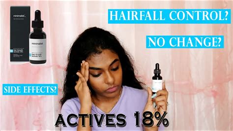 Minimalist Hair Growth Actives 18 Hair Regrowth Possible