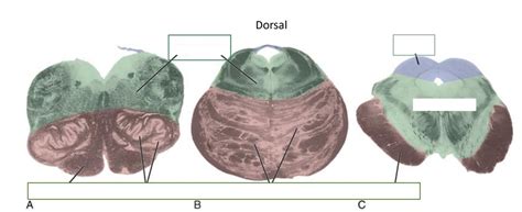 Brainstem Cross Section Diagram Quizlet