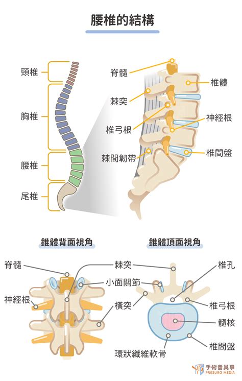 脊椎手術治療椎間盤突出、脊椎滑脫：手術原理、費用、後遺症