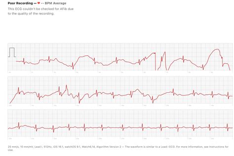 I have a lot of trapped gas in my chest today (I have IBS/reflux) which ...