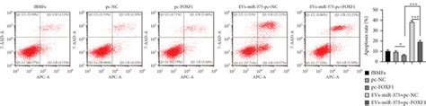 Ev Carried Mir 375 Inhibits The Fibrosis Of Fbmfs Via Targeting Foxf1