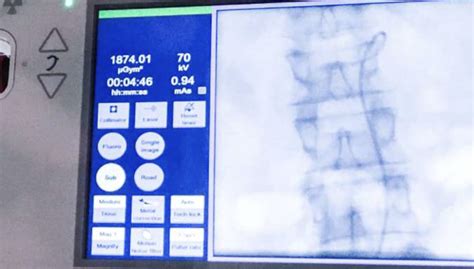 What Are The Differences Between Radiology And Interventional Radiology