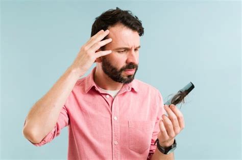 Is Dandruff Contagious and Can It Cause Hair Loss? – Stylorize