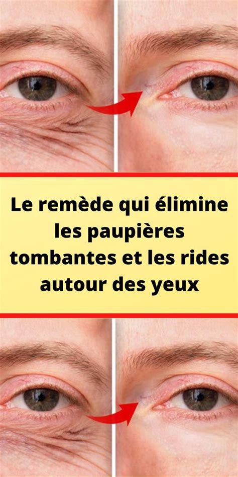 Le remède qui élimine les paupières tombantes et les rides autour des