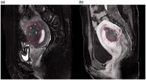 Full Article Factors Influencing The Ablative Efficiency Of High