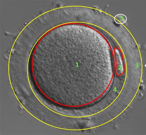 Image Of Oocyte In Stage Mii Cytoplasm Cpm First Polar Body