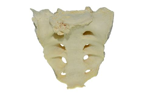 SACRUM – Clinical Anatomy