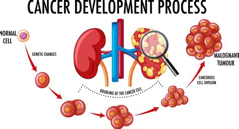 Diagram showing cancer development process 6611240 Vector Art at Vecteezy