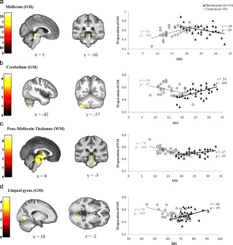 Structural Brain Regions With Significant Interactions Between Group