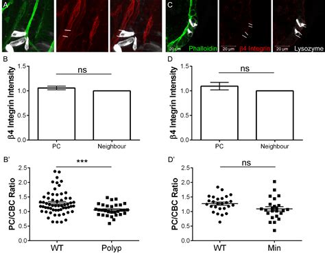 Paneth Cell Rich Regions Separated By A Cluster Of Lgr5 Cells Initiate