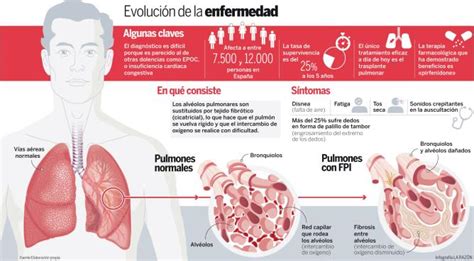 Fibrosis Pulmonar Idiopática Medicusmeo