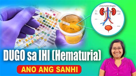 Dugo Sa Ihi Hematuria Ano Ang Sanhi Urinary Renal Disease