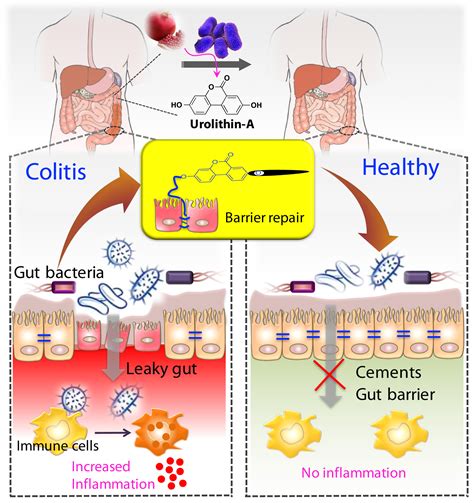 Gut Metabolite For The Treatment Of Colitis Vemula Lab