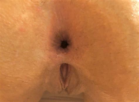 Wifeâs freshly fucked ass Porn Pic