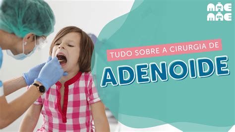 Adenoide o que é quando precisa de cirurgia e como cuidar