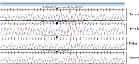 Sanger sequencing of the patients, and their parents. A heterozygous ... 