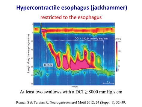 Esophageal Motility Disorders In Chicago Classification V30 Ppt