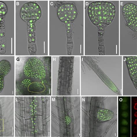 Expression Patterns Of Dr5 Rev Gfp In The Wild Type And Pcn