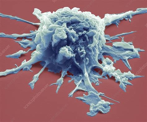 Macrophage Sem Stock Image C Science Photo Library