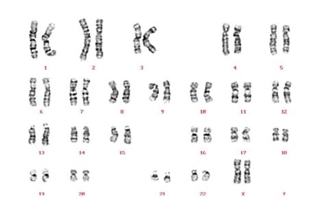 Solved 1 Circle The Sex Chromosomes On The Karyotype Image Chegg