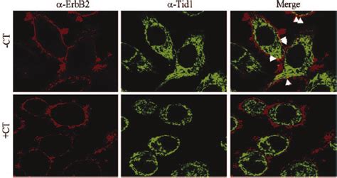 Colocalization Of Erbb And Tid In Mammary Carcinoma Cells Sk Br