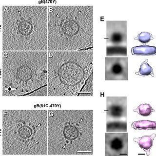 Microvesicles Expressing Full Length GB 470Y Or GB 81C 470Y Imaged By