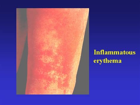 Cutaneous Symptoms And Signs Cutaneous Symptomssubjective Symptoms