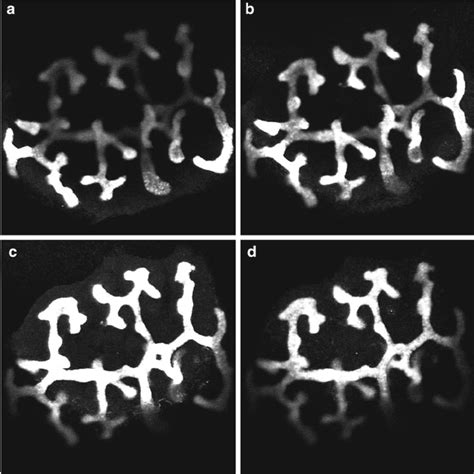 Confocal Optical Sections A Z Series Of Confocal Optical Sections Of