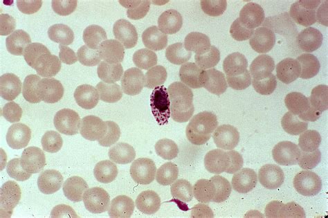 Free picture: photomicrograph, young, immature, plasmodium ovale, schizont 